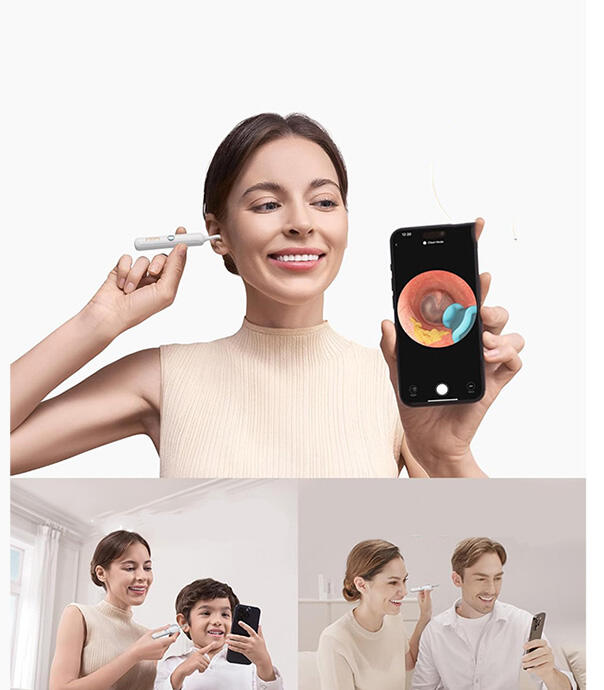 گوش پاک کن هوشمند شیائومی مدل Bebird R37R