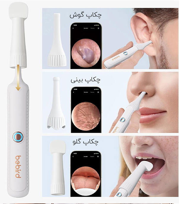 گوش پاک کن هوشمند شیائومی مدل Bebird R37R